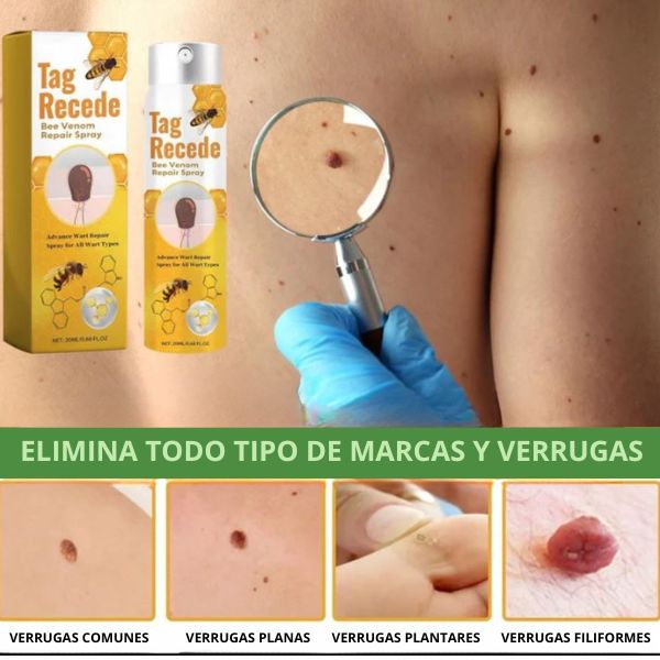BeeFree™ Despídete de verrugas y lunares en 5 días - Bee Venom Spray®