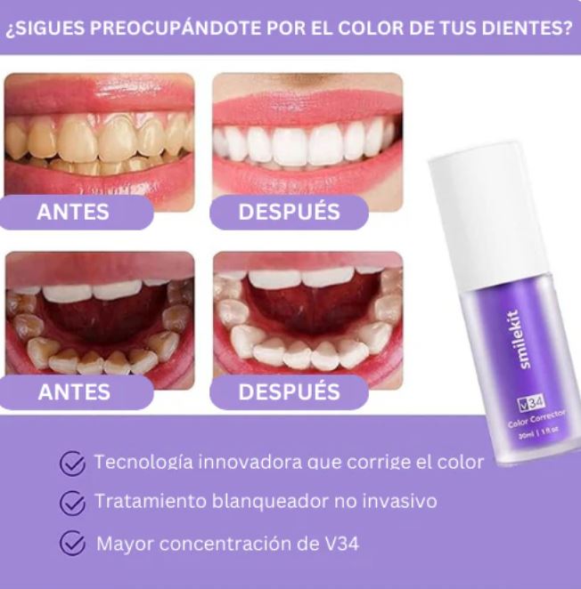 WhiteLuxe™ Transforma tu sonrisa con frescura – Whitening Formula®