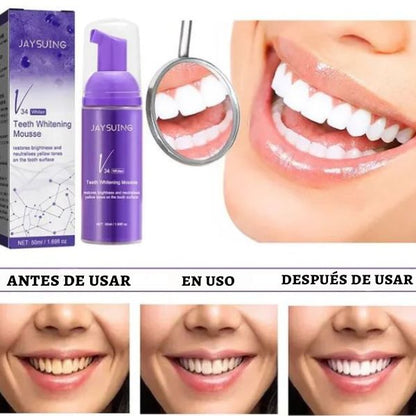 WhiteLuxe™ Transforma tu sonrisa con frescura – Whitening Formula®
