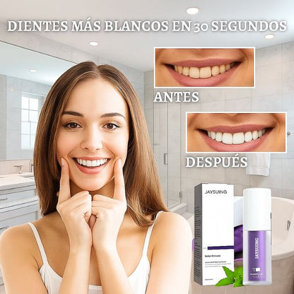 Renueva tu sonrisa con V34 – Whitening Formula®