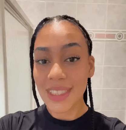 Renueva tu sonrisa con V34 – Whitening Formula®