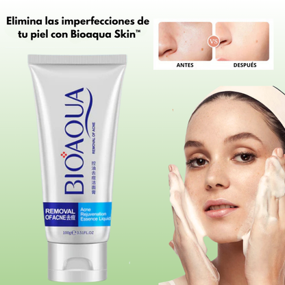 BIOAQUA SKIN™ - Di Adiós a las Imperfecciones y Recupera tu rostro