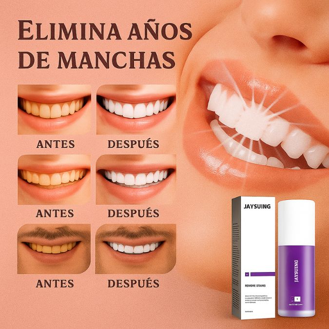 Renueva tu sonrisa con V34 – Whitening Formula®
