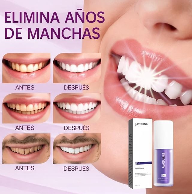 WhiteLuxe™ Transforma tu sonrisa con frescura – Whitening Formula®