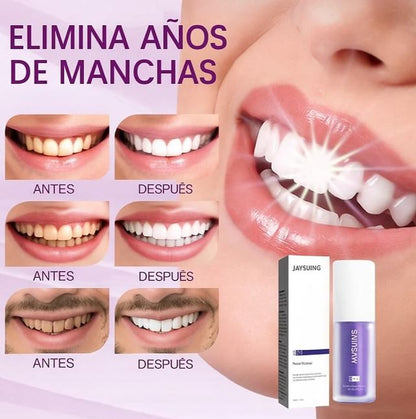 WhiteLuxe™ Transforma tu sonrisa con frescura – Whitening Formula®